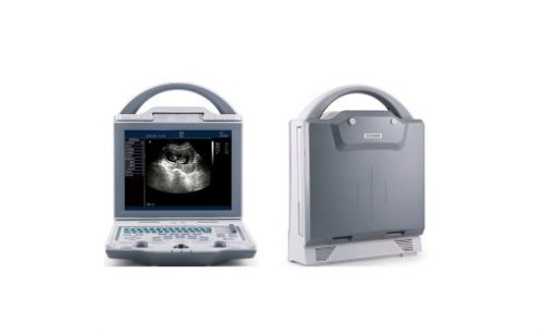 Portable Ultrasound Scanner